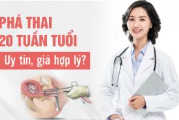 phá thai 20 tuần tuổi