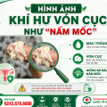 vung-kin-xuat-hien-mang-trang-nhu-nam-moc-coi-chung-viem-nhiem-phu-khoa-nang