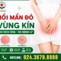 noi-man-do-vung-kin